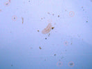 Acro Eating Flatworms 